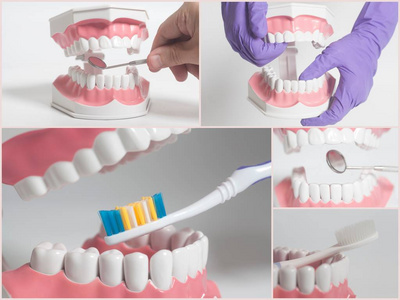 牙齿人体模型。牙科护理的概念。拼 贴