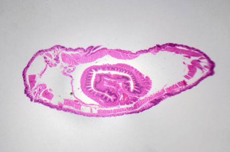 显微摄影。蚯蚓, 横断面