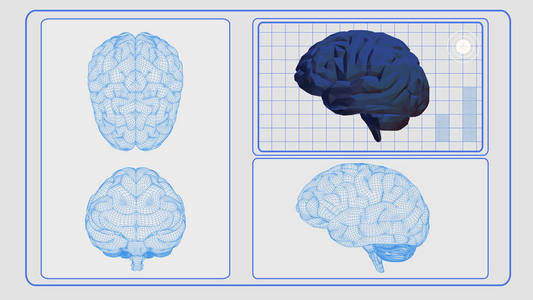 3d. 白 Bg 的脑分析界面屏幕