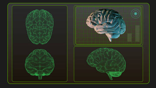 3d. 黑 Bg 的脑分析界面屏幕