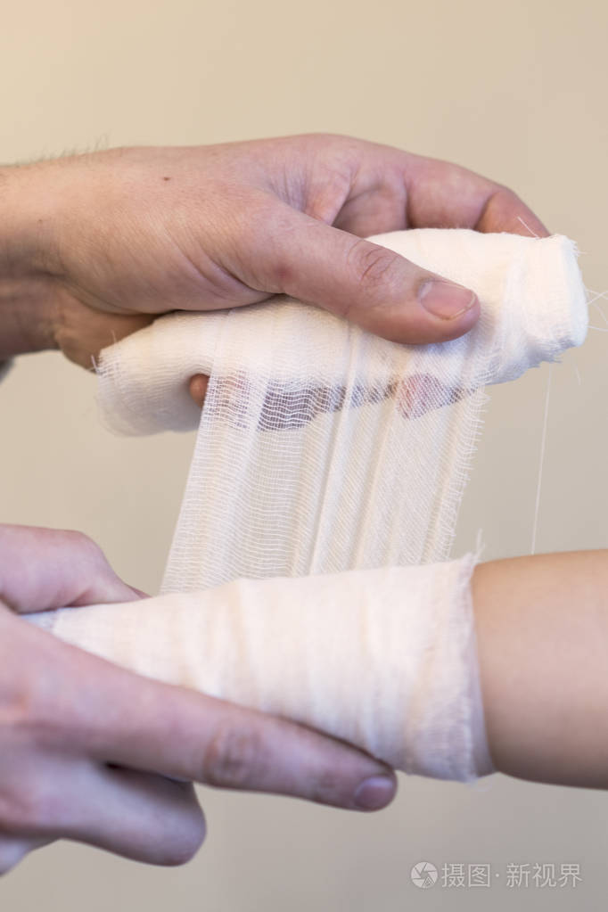 儿科医生包扎孩子的手臂.医生弯曲了孩子的手.特写