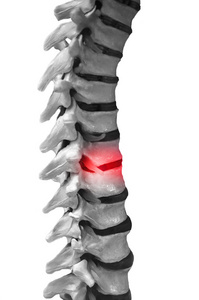 人体脊柱脊髓模型