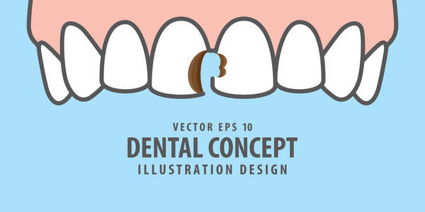 蓝色 backgrou 上腔牙图示矢量