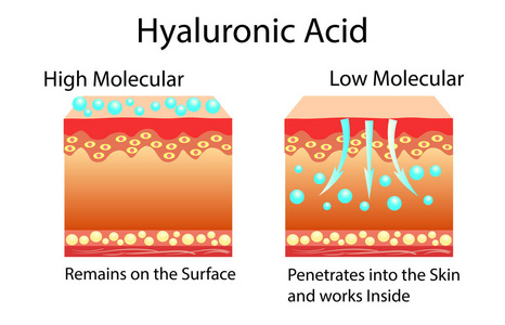 皮肤护理产品中透明质酸的矢量插图。低分子和高分子