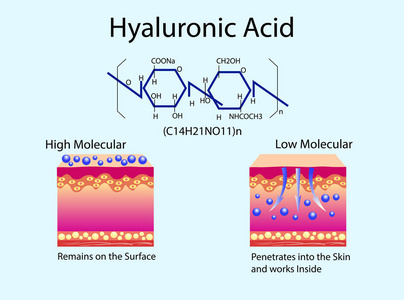 皮肤护理产品中透明质酸的矢量插图。低分子和高分子