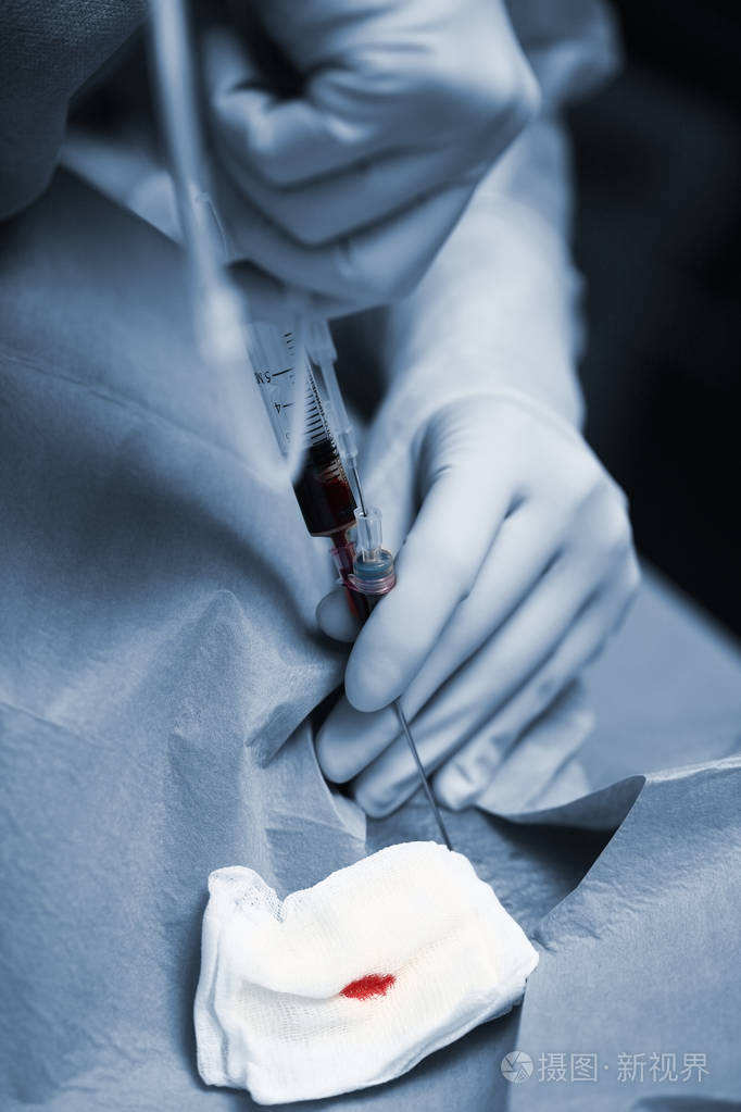 医生在插管期间用血注射器手