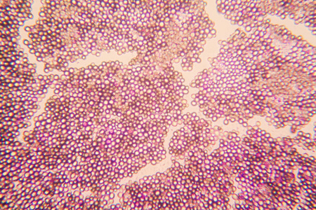 红酒酵母酵母在显微镜照片