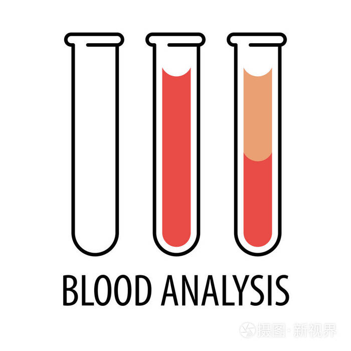 血浆和层红色血细胞插画