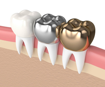 3d. 不同类型牙冠牙的渲染