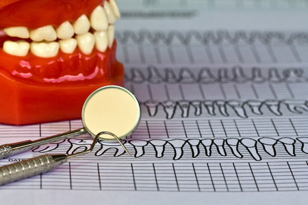 牙齿的工具和设备牙科图表上