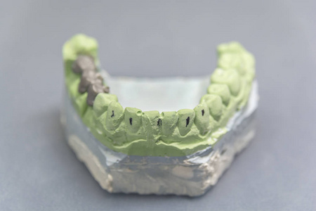 用金属桥在灰桌上种植绿色牙牙的石膏图案