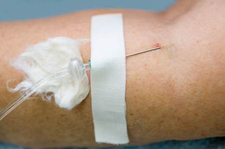 容积内映射针图片