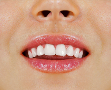 女人的牙齿图片