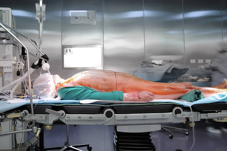 现代手术室 surgeical 表的资深病人无菌制服医务工作者的模糊剪影
