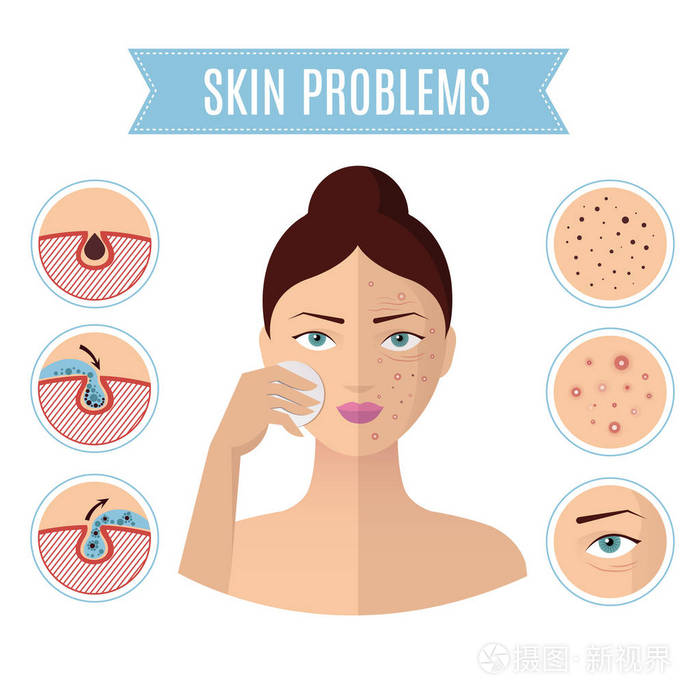 皮肤问题解决, 痤疮治疗和清洁毛孔完人脸矢量图标