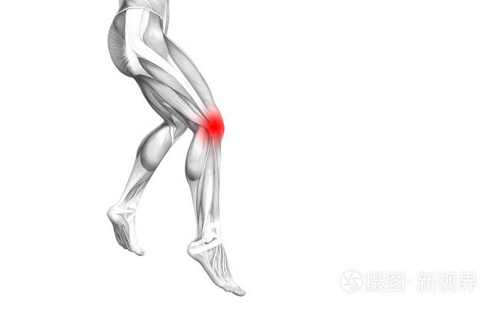 概念性膝关节人体解剖学与红点炎症或关节疼痛的腿保健治疗或运动肌肉