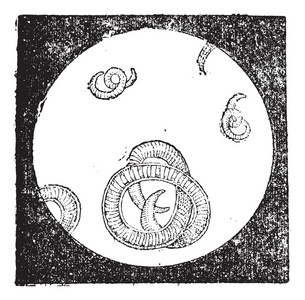 旋毛虫或旋毛虫蠕虫复古雕刻照片