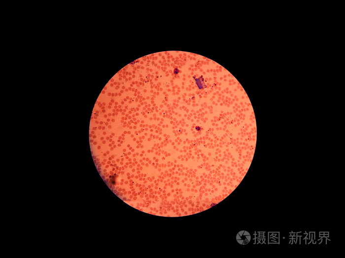 显微镜下的血液细胞