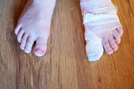 小男孩脚与受伤痛苦左脚用白色纱布绷带在棕色地板背景顶部查看特写