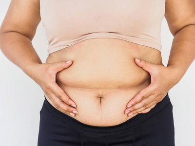 女人手捧着自己的腹部脂肪。女性饮食生活方式减少腹部和塑造健康胃肌肉概念
