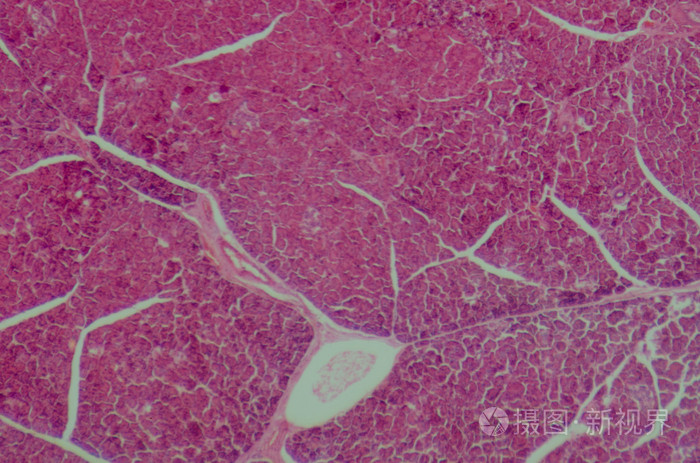 人胰腺的微观部分