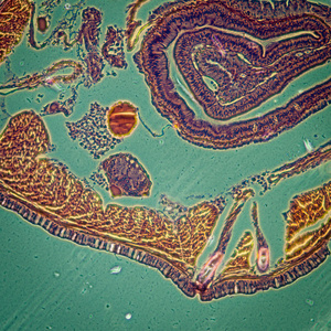 显微镜下蚯蚓横切照片
