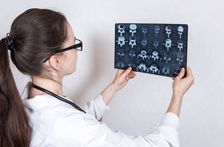 戴眼镜的年轻女子黑发医生和一件医用白大衣检查白色背景上的 x 光镜头
