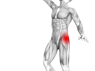 带红色热斑炎症的概念性髋部人体解剖学照片