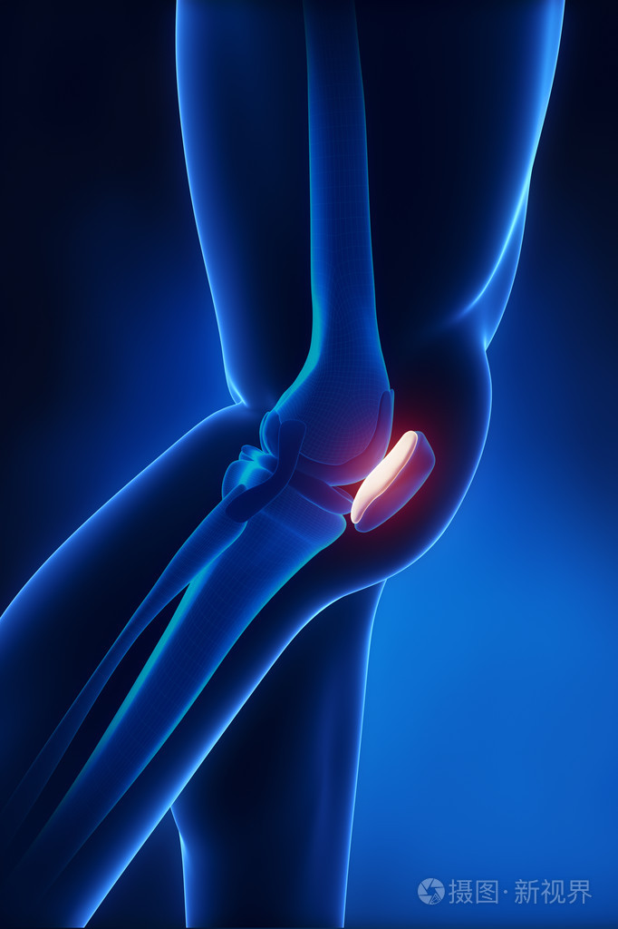 髌骨解剖横向视图