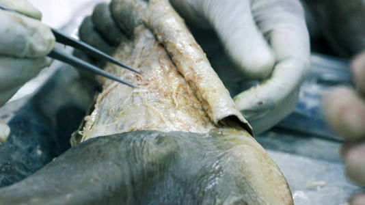 用手术刀剪和钳割皮瓣显示足背的解剖解剖血管神经的重要结构