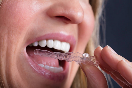 女性手的特写把透明的光刻在牙齿上照片