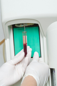女人 performin 血液测试
