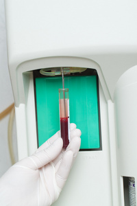 女人 performin 血液测试