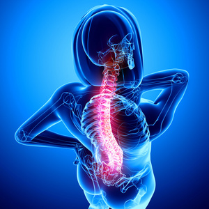 女性脊柱疼痛