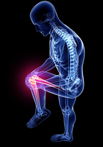 男性膝关节疼痛