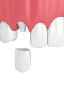 3d. 在白色背景下用牙齿和牙齿犬冠渲染上颌下颌