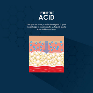 透明质酸填料注入信息图