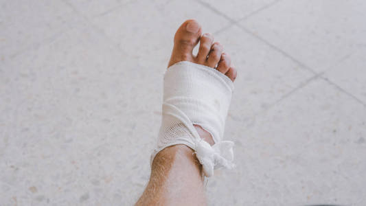 旅行保护磨损后包扎腿.在旅行中保护划伤的身体部位照片