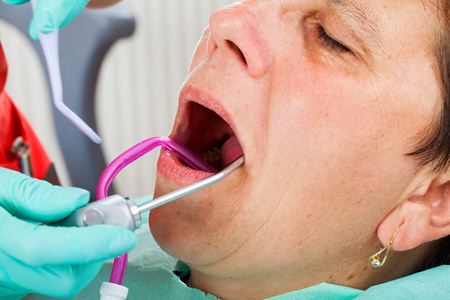 资深妇女在牙医椅子与嘴开放 durring 牙科治疗