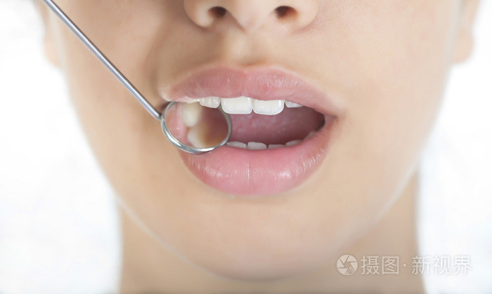 美丽的微笑与口腔镜照片-正版商用图片064ici-摄图新视界