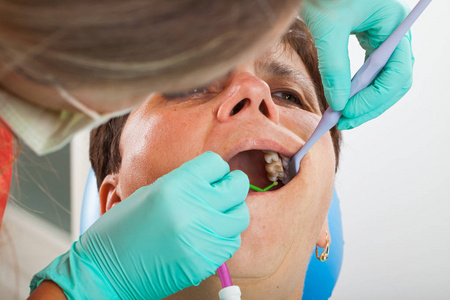 资深妇女在牙医椅子与嘴开放 durring 牙科治疗