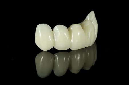 牙齿冠桥图片