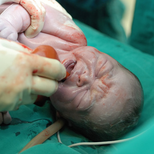 新出生的婴儿新生儿手术室新出生的婴儿新生的孩子秒和分钟后新出生的