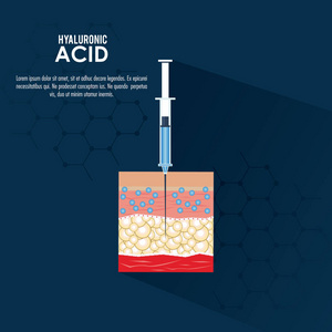 透明质酸填料注入信息图