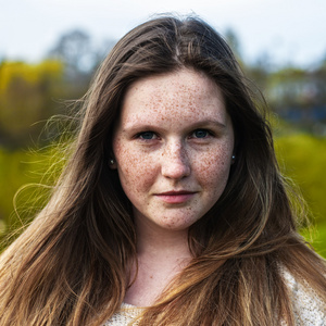 雀斑,一个漂亮女孩的肖像特写照片