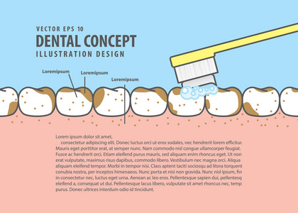 布局刷牙非常肮脏的牙齿卡通风格的信息或书籍