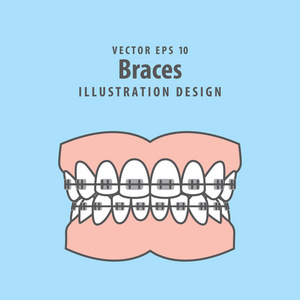 在蓝色背景上的大括号齿 完全 插图向量。Denta