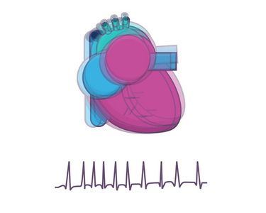 心脏跳动的快速图示照片