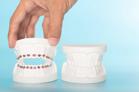 口腔健康概念中的正畸牙科模型图片