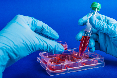 戴手套的手保持管的血液分析。塑料实验室设备用于科学研究